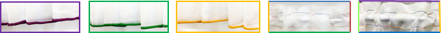 Accent-Color -Thread